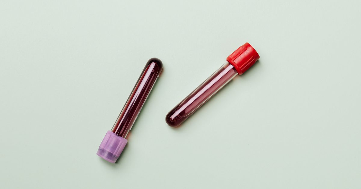Two blood sample tubes on a mint-green background, representing a routine blood test