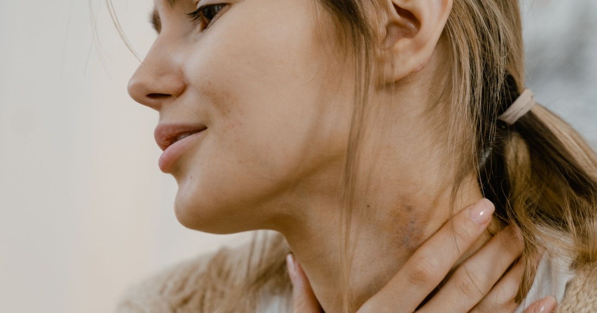 A woman resting her hand on her throat over the thyroid area
